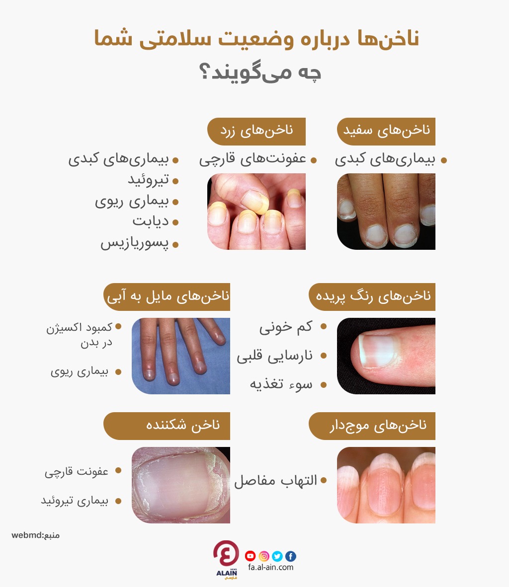 رنگ ناخن نمایان‌گر چه بیماری است؟